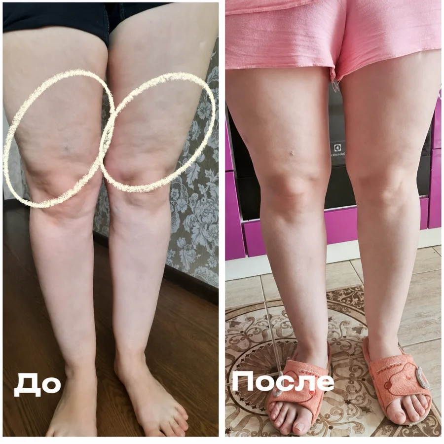 Результат участницы: до и после